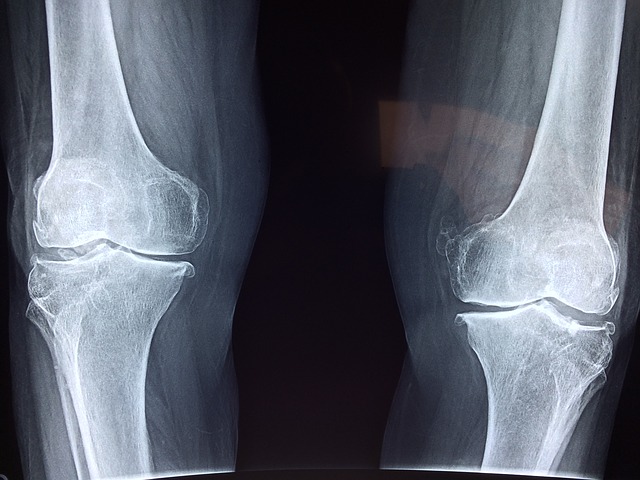 Orthopedic Malpractice Atlanta