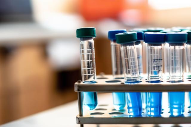 A close-up of a medical test tube rack with labeled vials and a dropper, symbolizing the diagnostic process.