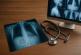 Delayed Diagnosis in Radiology
