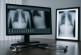 Failure to Detect Tumors in Radiology